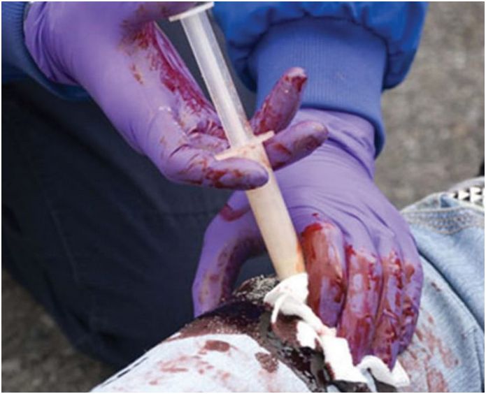 Proszki hemostatyczne Med Trade CELOX-A