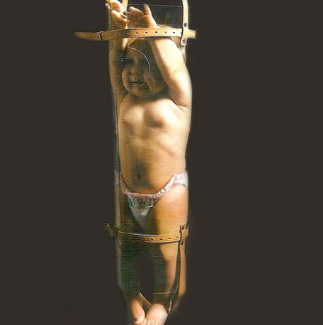 Przyrządy do stabilizacji niemowląt podczas badań RTG MD SUMED BOBIX