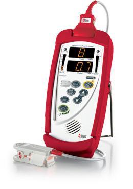 Pulsoksymetry ręczne (przenośne) Masimo Masimo Rad 57m