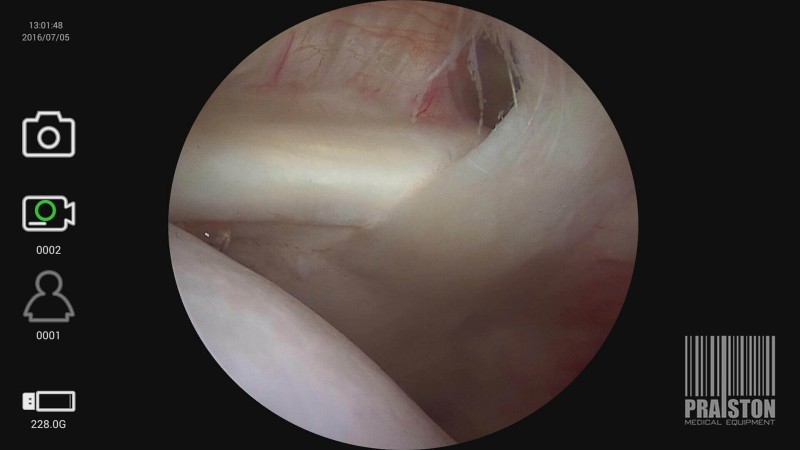 Rejestratory medyczne (badań medycznych) MEDI CAPTURE MVR Lite Full HD