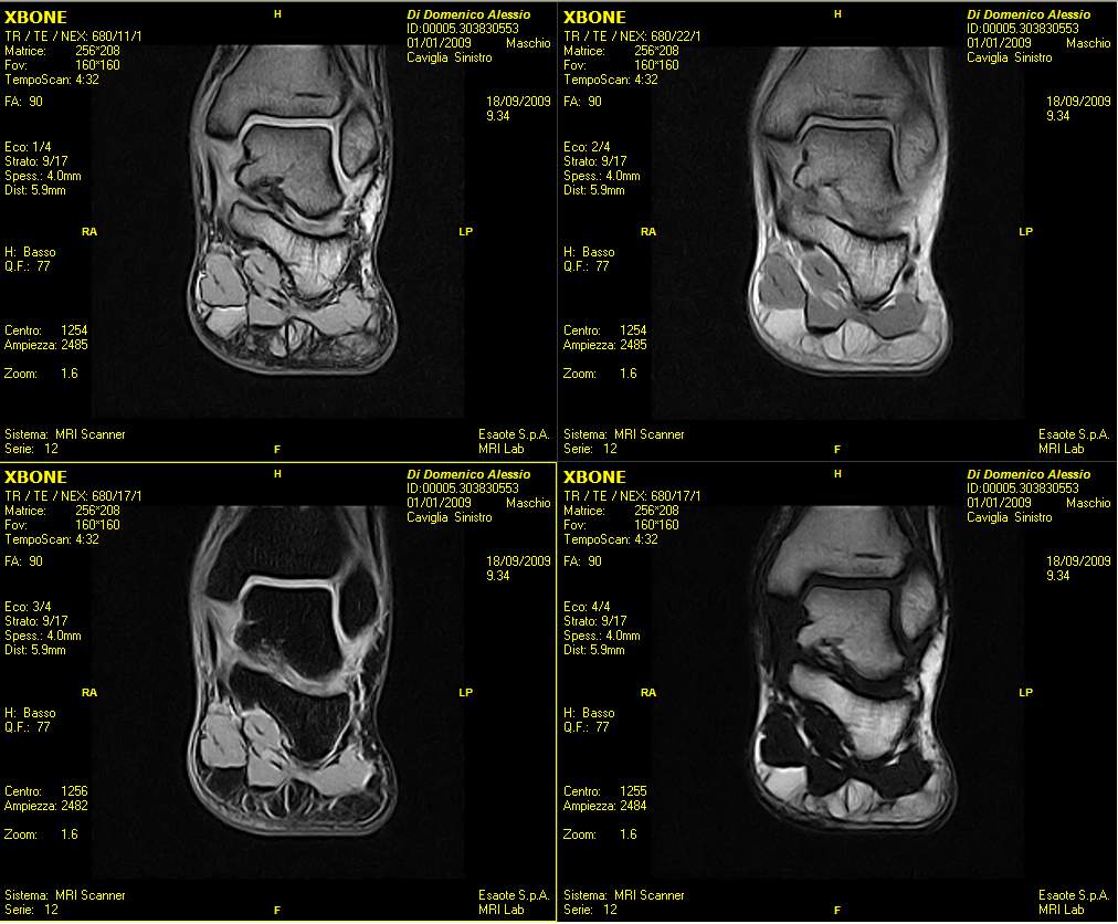 Rezonans magnetyczny (MRI) ESAOTE O-scan