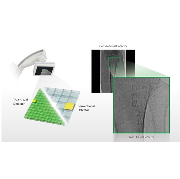 RTG do kardioangiografii Canon Alphenix SKY+