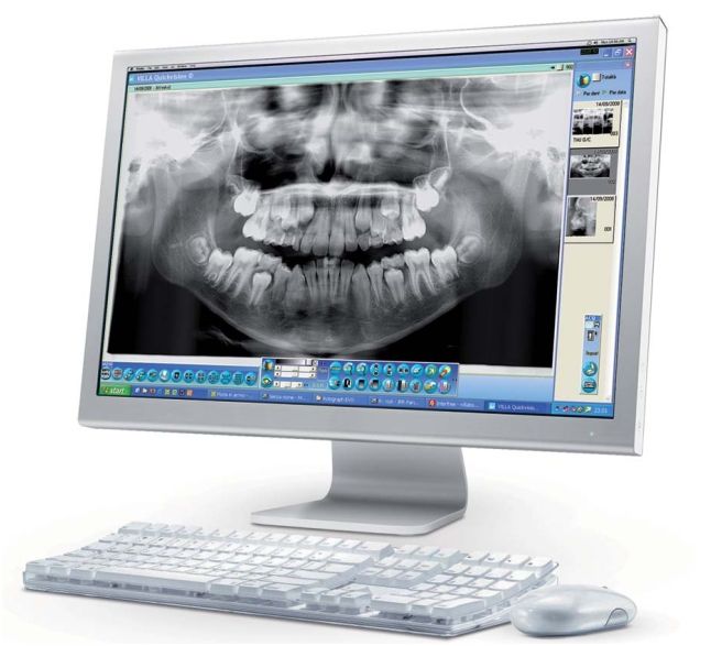 RTG pantomograficzne Villa Sistemi Medicali Rotograph EVO D