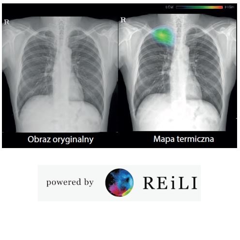 RTG przyłóżkowe i mobilne FUJIFILM FDR Nano + AI
