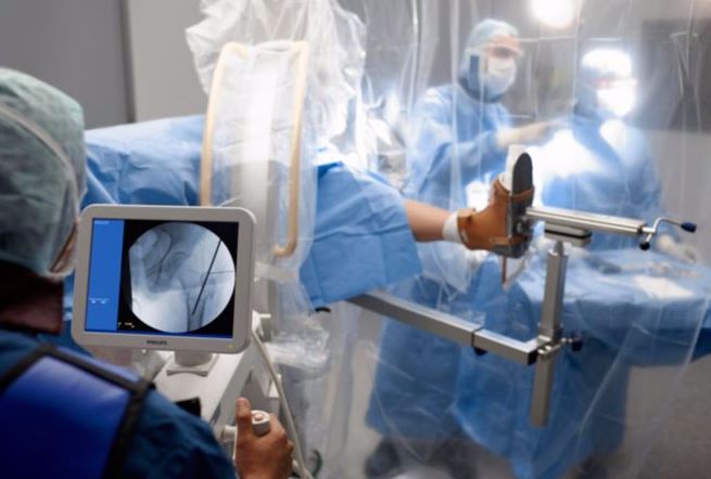 RTG śródoperacyjne (Ramię C) PHILIPS BV Pulsera