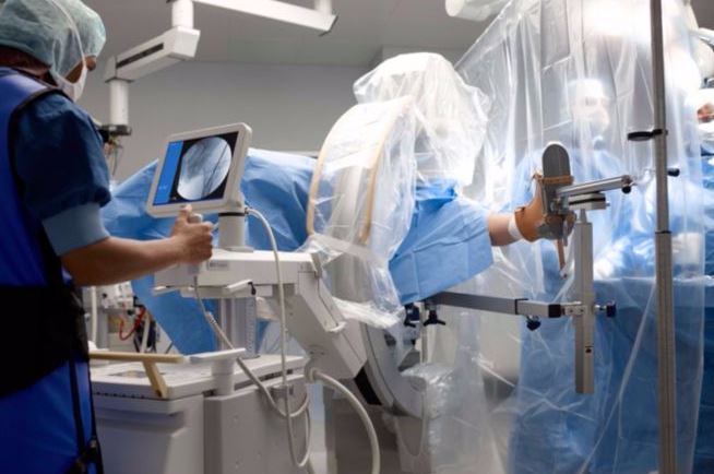 RTG śródoperacyjne (Ramię C) PHILIPS BV Pulsera