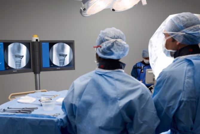 RTG śródoperacyjne (Ramię C) PHILIPS BV Pulsera