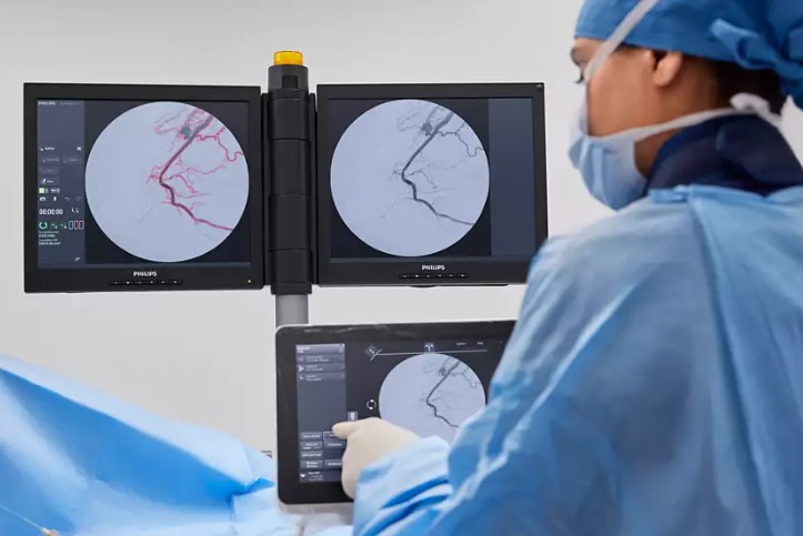 RTG śródoperacyjne (Ramię C) PHILIPS Zenition 90 Motorized