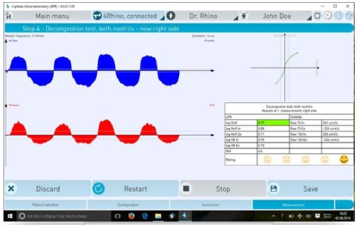 Rynomanometry Rhinolab 4RHINO