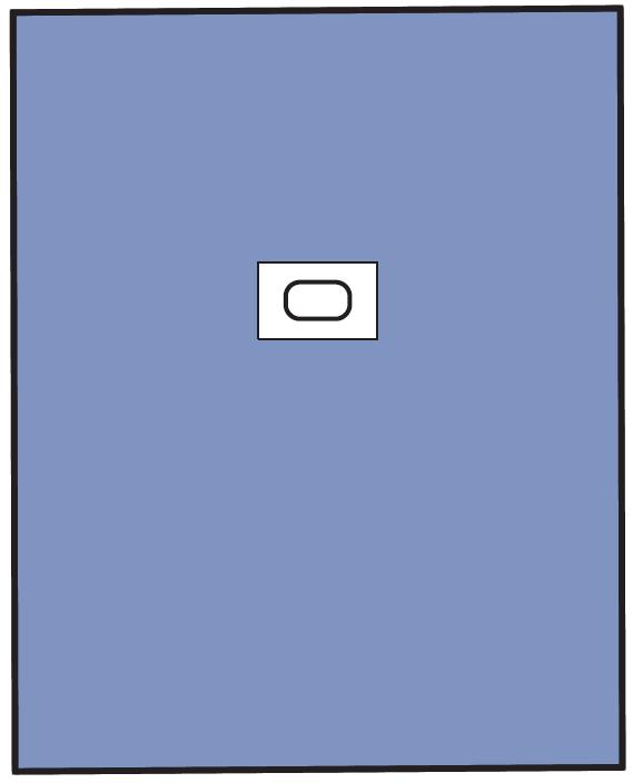 Serwety operacyjne – obłożenie pola operacyjnego OneMed 1535-02