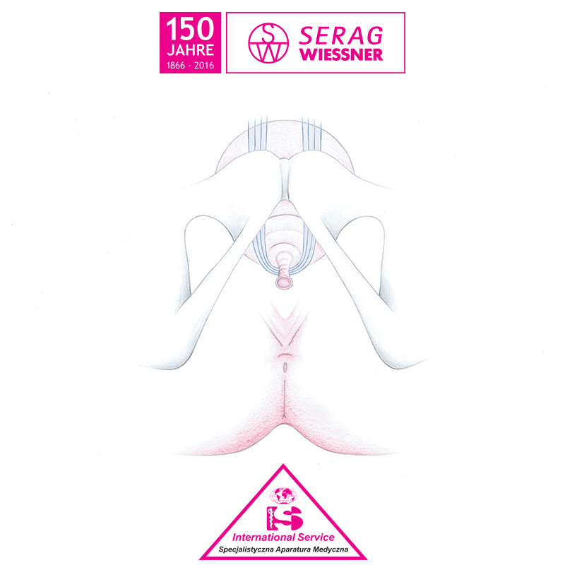 Siatki i taśmy do zabiegów urologicznych Serag Wiessner SeraSis PA
