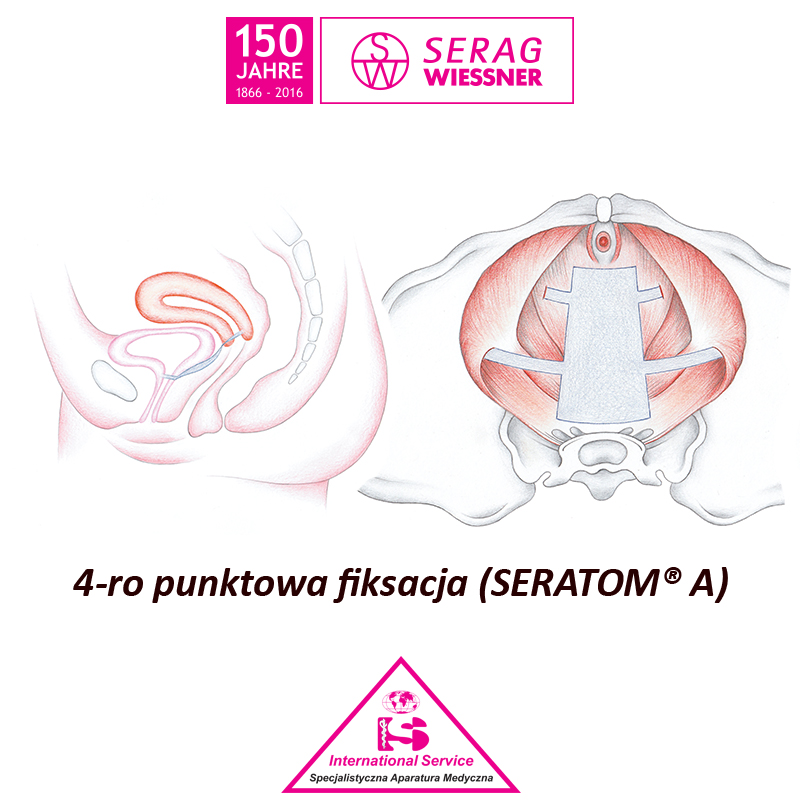 Siatki i taśmy do zabiegów urologicznych Serag Wiessner SERATOM PA