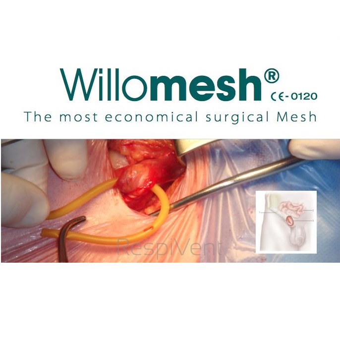 Siatki przepuklinowe Will-Pharma Willomesh