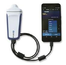 Skanery pęcherza Signostics UScan