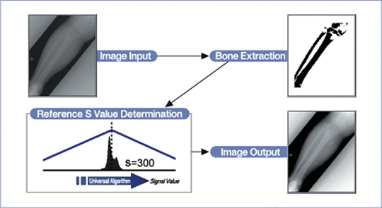 Skanery płyt obrazowych (radiografia pośrednia) Konica Minolta Regius SIGMA II