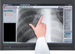 Skanery płyt obrazowych (radiografia pośrednia) Konica Minolta Regius SIGMA II