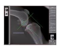 Skanery płyt obrazowych (radiografia pośrednia) OR Technology Divario CR-T2/Tm
