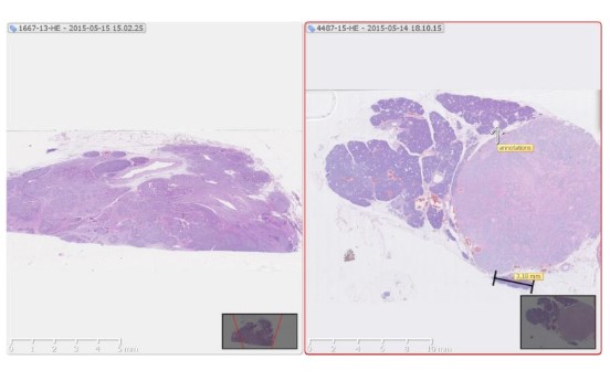 Skanery szkiełek mikroskopowych Hamamatsu NanoZoomer S540MD