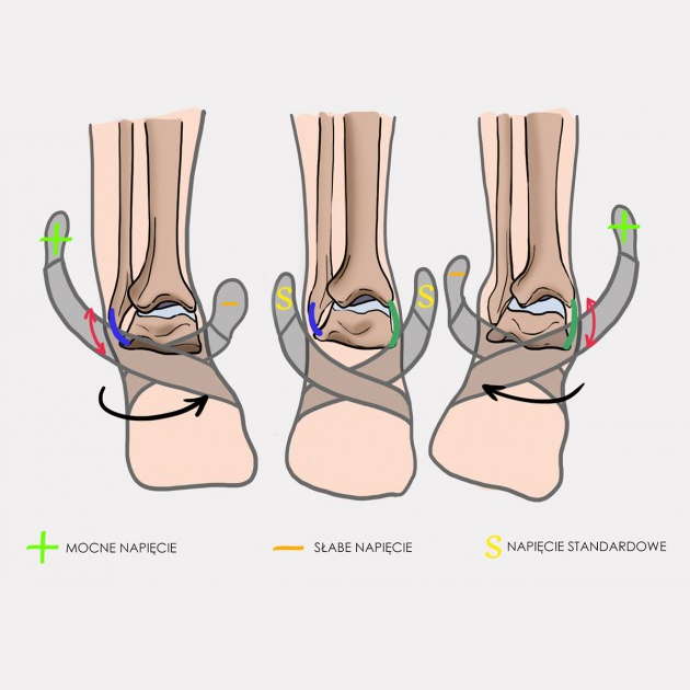 Stabilizatory stawu skokowego REH4MAT AM-OSS-12