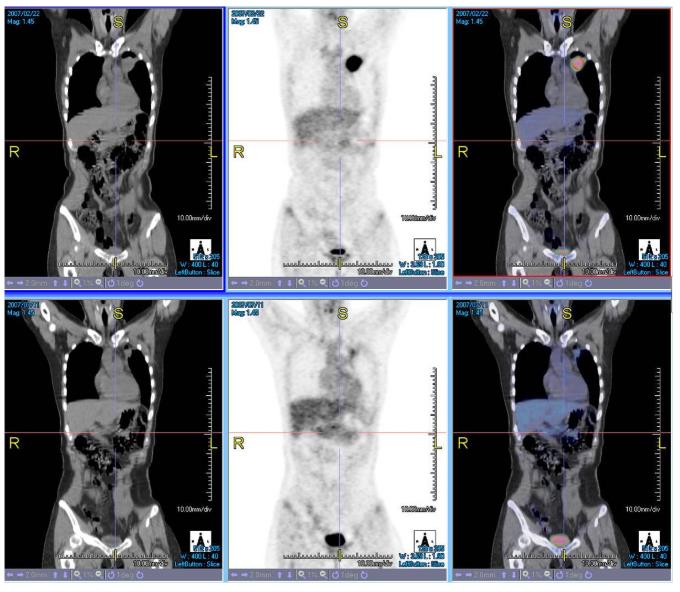 Stacje diagnostyczne obrazów medycznych TeraRecon Aquarius