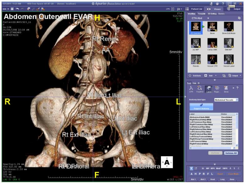 Stacje diagnostyczne obrazów medycznych TeraRecon Aquarius