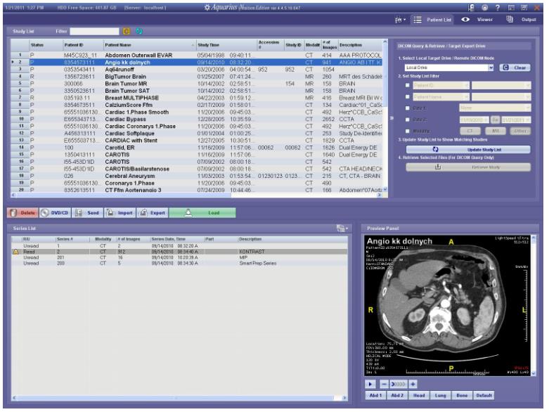 Stacje diagnostyczne obrazów medycznych TeraRecon Aquarius