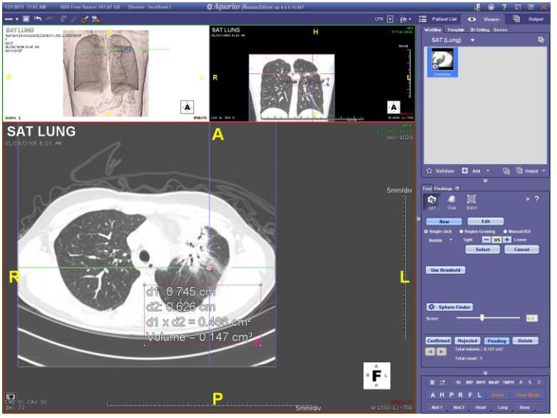Stacje diagnostyczne obrazów medycznych TeraRecon Aquarius