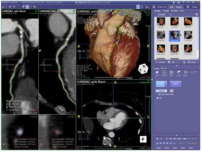 Stacje diagnostyczne obrazów medycznych TeraRecon Aquarius