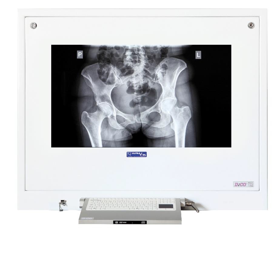 Stacje przeglądowe obrazów medycznych na sale operacyjne ULTRAVIOL DICO 1M 43" STACJA PRZEGLĄDOWA CYFROWYCH OBRAZÓW MEDYCZNYCH