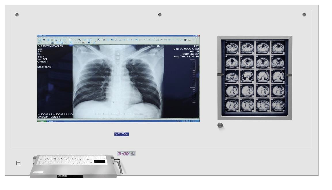 Stacje przeglądowe obrazów medycznych na sale operacyjne ULTRAVIOL DICO 1M/1B 43" STACJA PRZEGLĄDOWA CYFROWYCH OBRAZÓW MEDYCZNYCH