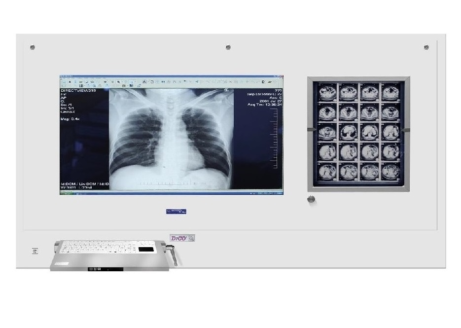 Stacje przeglądowe obrazów medycznych na sale operacyjne ULTRAVIOL DICO 1M/1B 49" STACJA PRZEGLĄDOWA CYFROWYCH OBRAZÓW MEDYCZNYCH