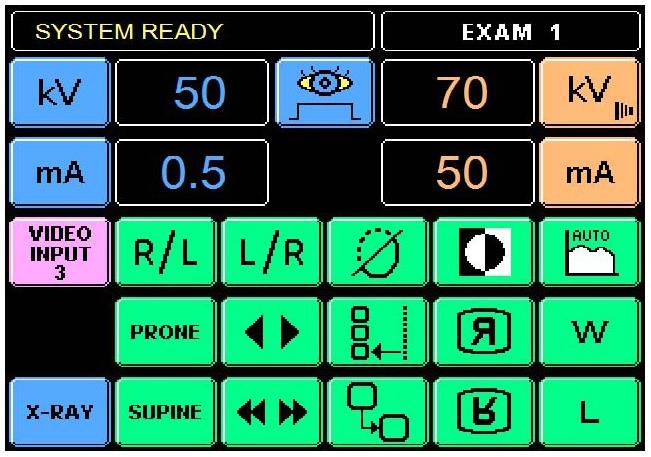Stoły rentgenodiagnostyczne Primax UROMAT DFD