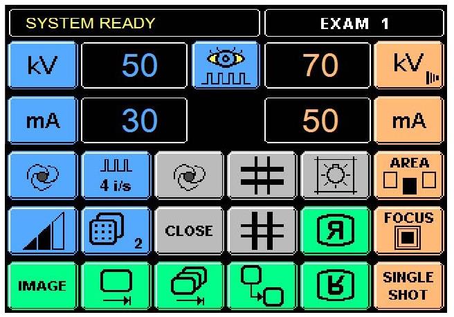 Stoły rentgenodiagnostyczne Primax UROMAT DFD
