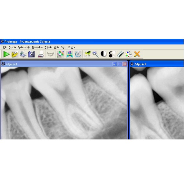 Stomatologiczne detektory cyfrowe EVA Digital Intraoral X-Ray