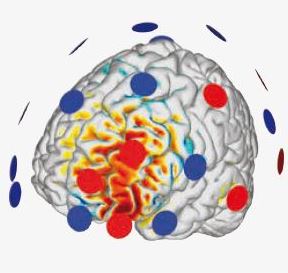 Stymulatory elektryczne przezczaszkowe (tCS) Neuroelectrics StarStim 32 EEG