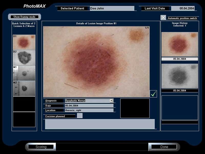 Systemy archiwizacji obrazów medycznych (PACS) DERMA MEDICAL PhotoMAX