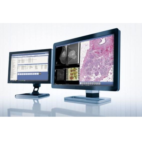 Systemy archiwizacji obrazów medycznych (PACS) SECTRA Sectra PACS