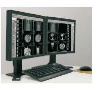 Systemy archiwizacji obrazów medycznych (PACS) VISUS JiveX PACS