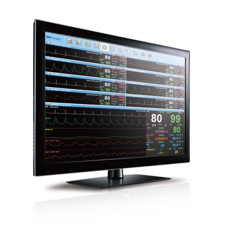 Systemy centralnego monitorowania – centrale pielęgniarskie Bionet BM Central