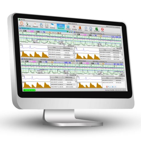 Systemy centralnego monitorowania – centrale pielęgniarskie EDAN CENTRALA KTG