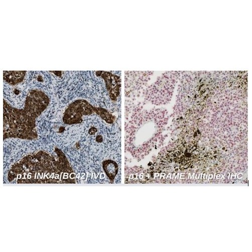 Systemy do barwień immunohistochemicznych Biocare ONCORE PRO