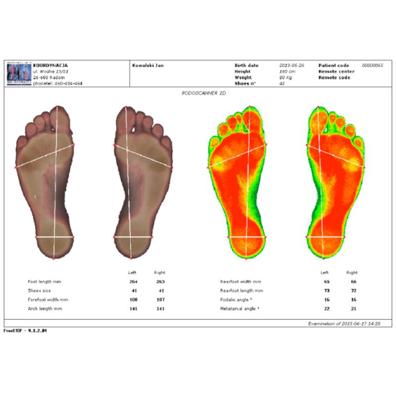 Systemy do diagnostyki badania chodu i postawy Koordynacja FreeMed Posture