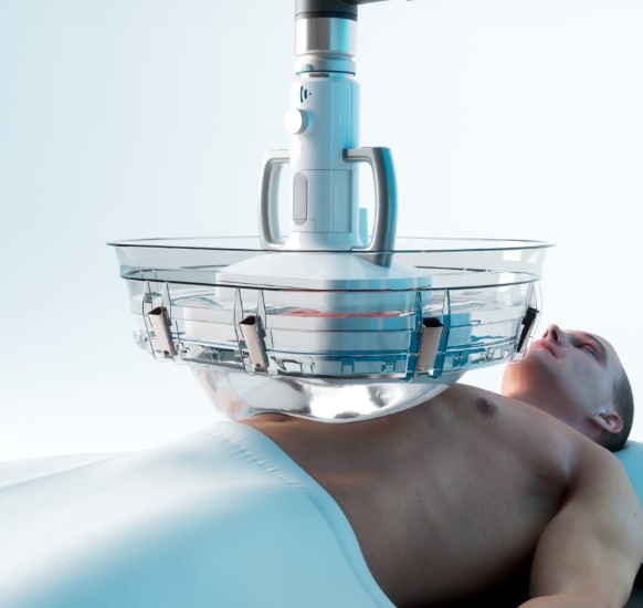 Systemy do histotrypsji HistoSonics Edison