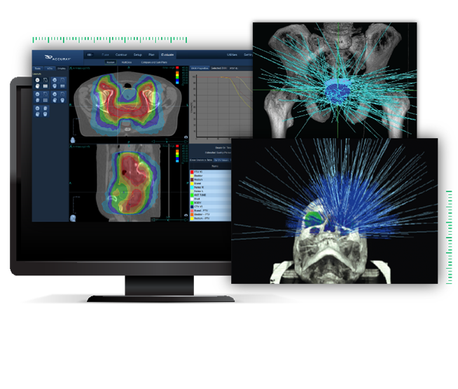 Systemy do stereotaktycznej radiochirurgii Accuray CyberKnife S7