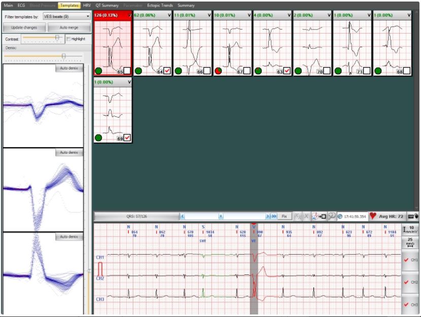 Systemy holterowskie EKG Labtech EC-12H
