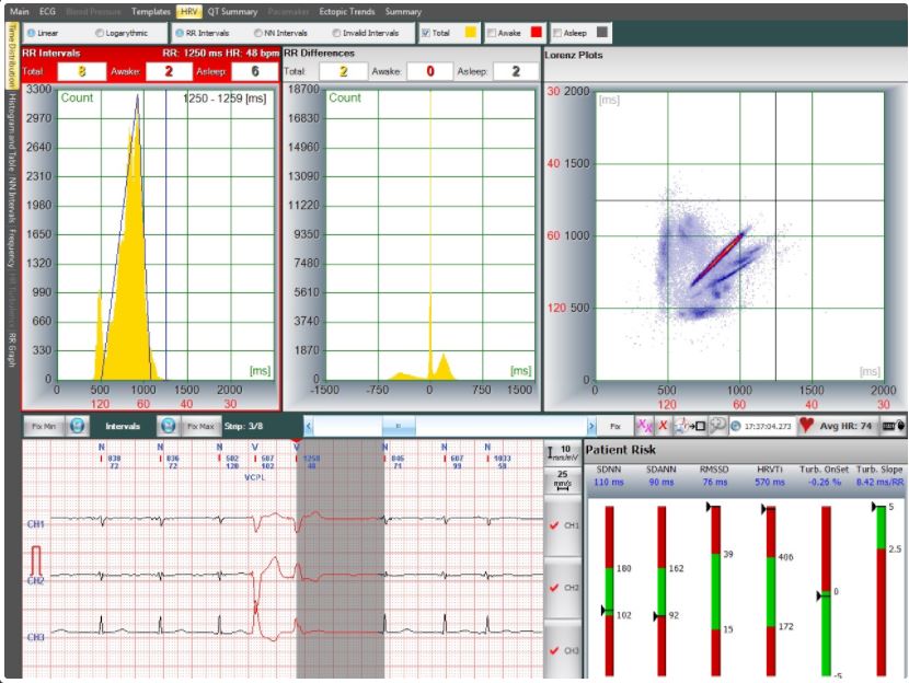 Systemy holterowskie EKG Labtech EC-12H