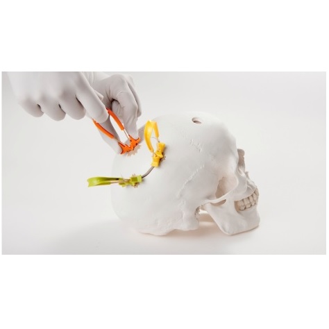 Systemy mocowania płatów czaszkowych NEOS Surgery Cranial LOOP