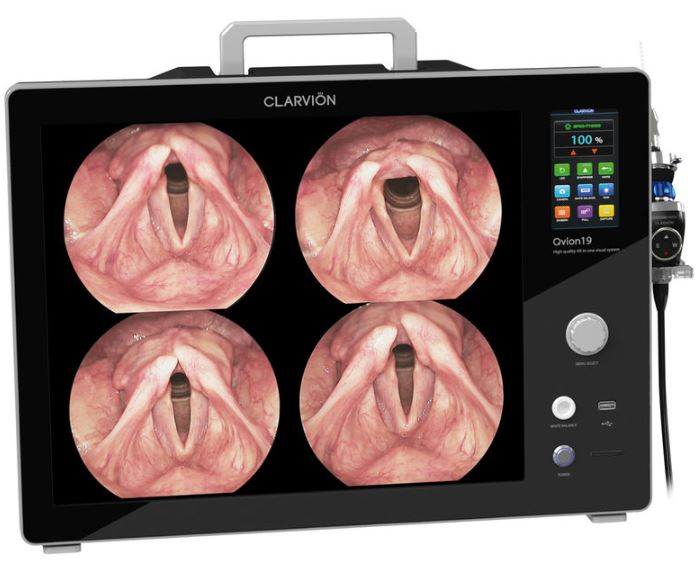 Systemy obrazowania do endoskopów sztywnych Clarvion QVION 19