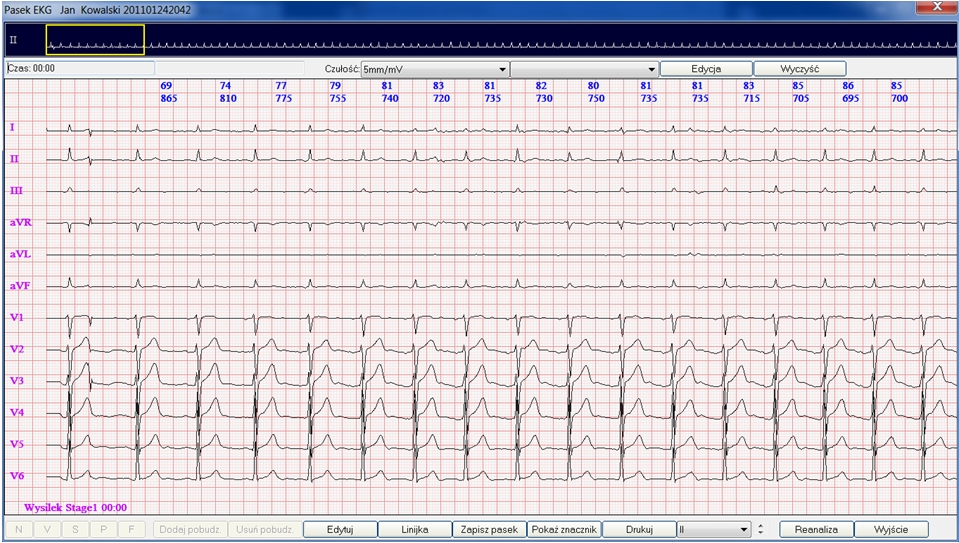 Systemy prób wysiłkowych DM Software CardioScan Stress Test 4.0