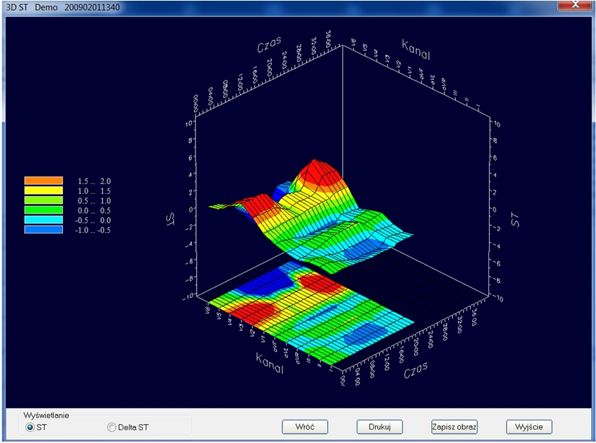 Systemy prób wysiłkowych DM Software CardioScan Stress Test 4.0